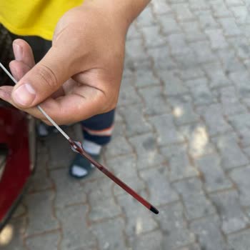 Hyundai Kona: Servis Hataları Ve Müşteri Mağduriyeti