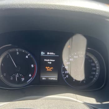 Hyundai Kona: Servis Hataları Ve Müşteri Mağduriyeti