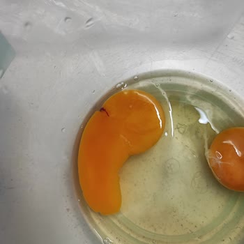 Yumurtada Kan: Mağduriyetimin Giderilmesini İstiyorum