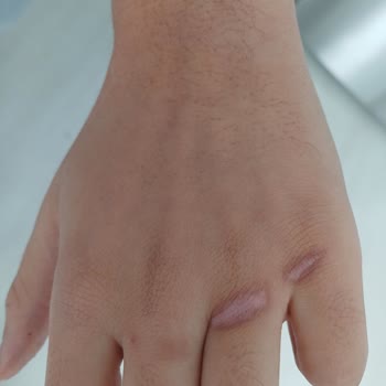 Schafer Tava Kulpları Aşırı Isınıyor, Güvenilir Mi