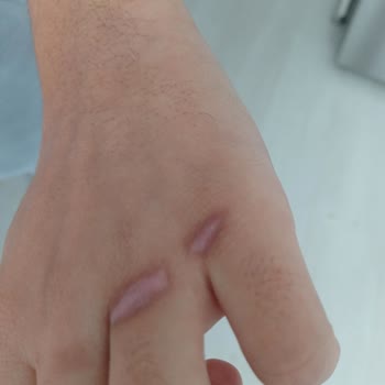 Schafer Tava Kulpları Aşırı Isınıyor, Güvenilir Mi