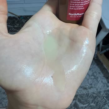 NorthPharma Laktofe Sr İçinden Çıkan Cisim