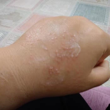 Veet Alerji Ve Tahriş Yapan Tüy Dökücü Krem