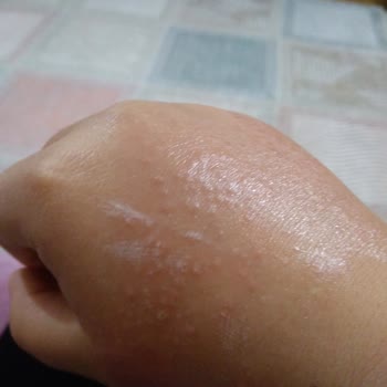 Veet Alerji Ve Tahriş Yapan Tüy Dökücü Krem