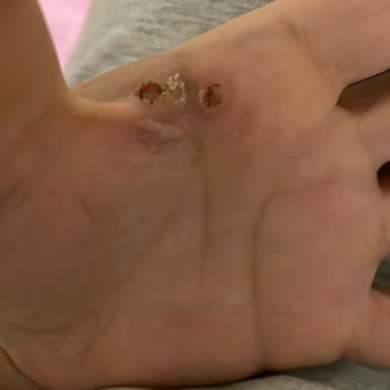 Fakir Marka Saç Maşası Elektrik Çarpması Tehlikesi