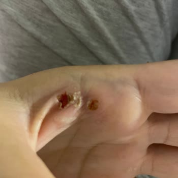 Fakir Marka Saç Maşası Elektrik Çarpması Tehlikesi