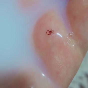 Dermokil Şampuanında Şok Edici Böcek Problemi