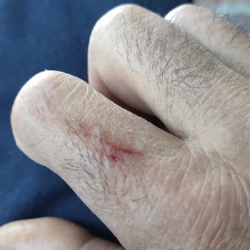 Arçelik Buzdolabı Raflarındaki Keskinlik Sorunu