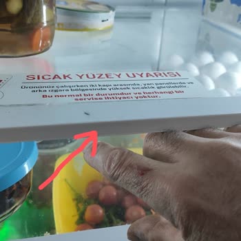Arçelik Buzdolabı Raflarındaki Keskinlik Sorunu
