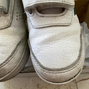 Adidas Ayakkabının Kalitesi Ve Müşteri Hizmeti Sorunu