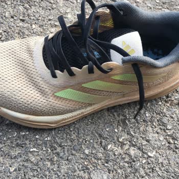 Adidas Ayakkabının Kalitesi Hayal Kırıklığı Yarattı!