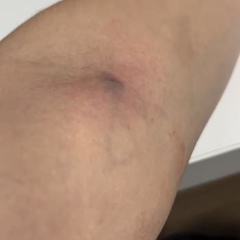 Hastanede Yaşanan Kaba Davranış Ve İlgisizlik