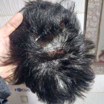 20.000 TL'lik Saç Döküldü, Üretim Hatası Kabul Edilmiyor