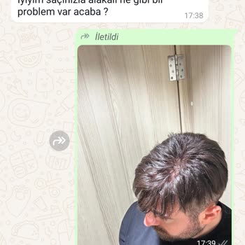 20.000 TL'lik Saç Döküldü, Üretim Hatası Kabul Edilmiyor