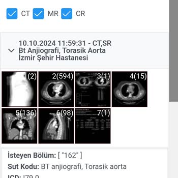 BT Anjiyografi Raporu Beklerken Sabır Tükeniyor