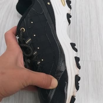 Kısa Sürede Deforme Olan Skechers Ayakkabı Hayal Kırıklığı