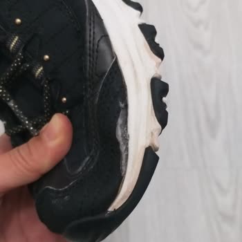 Kısa Sürede Deforme Olan Skechers Ayakkabı Hayal Kırıklığı