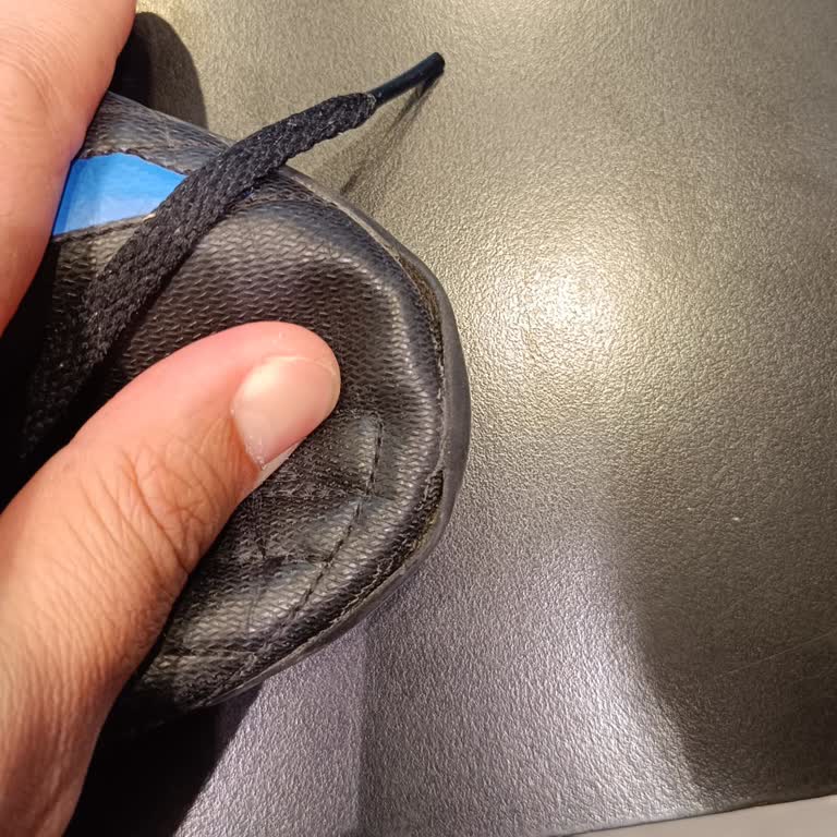 Adidas Ayakkabıda Açılma Sorunu Ve Yetersiz Müşteri Hizmeti