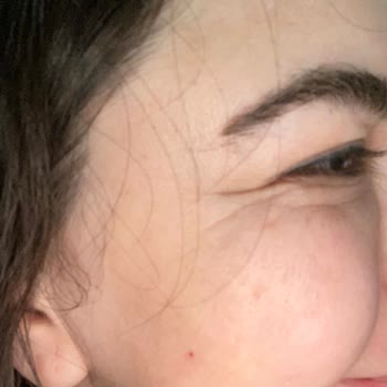 Clinimed Deneme Tahtası Gibi Hizmet: Tecrübesiz Ellerde Hayal Kırıklığı