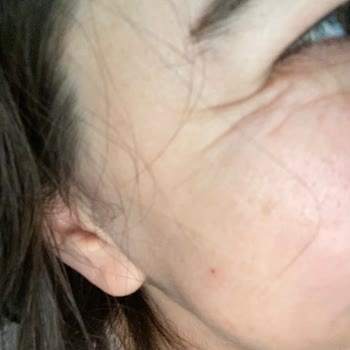 Clinimed Deneme Tahtası Gibi Hizmet: Tecrübesiz Ellerde Hayal Kırıklığı