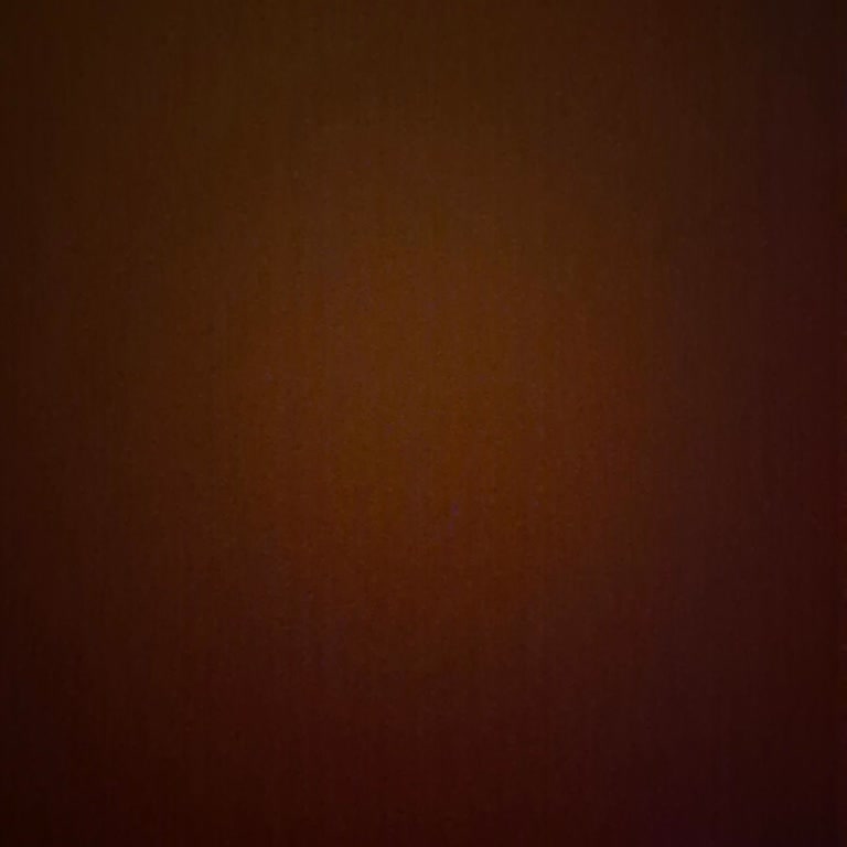 Teknosa'da Sürekli Eksik Olan Ekran Koruyucu