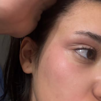 Effaclar Duo Seti İle Cilt Sorunları