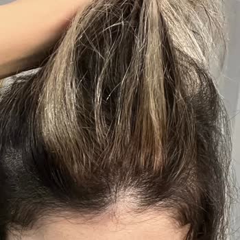 Mehmet Can Akbaş Hair İstediğim Renk İle Alakasız Bir Saç Yaptı