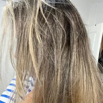 Mehmet Can Akbaş Hair İstediğim Renk İle Alakasız Bir Saç Yaptı