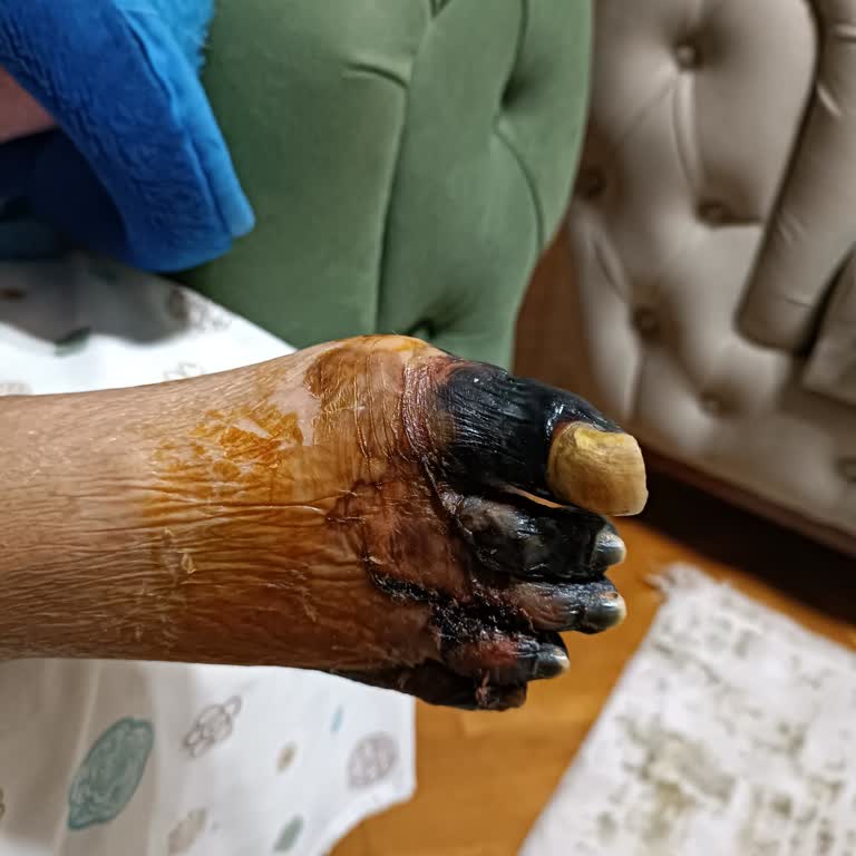 Sağlıkta İhmalkârlık: Ameliyat Sözü Tutulmadı