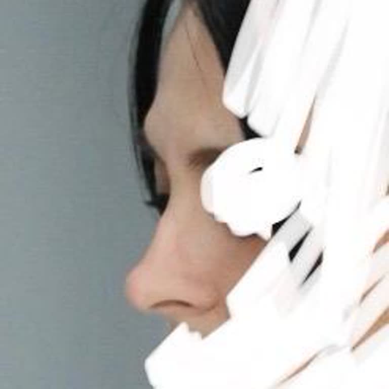 Burun Ameliyatı Hayal Kırıklığı