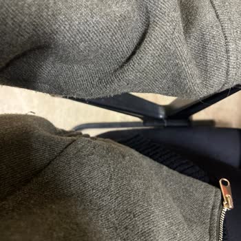 Zara Kaşe Cekette Beklenmedik Tüylü Sorun