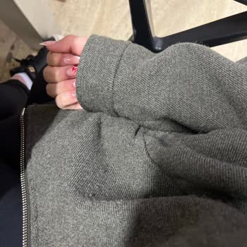 Zara Kaşe Cekette Beklenmedik Tüylü Sorun