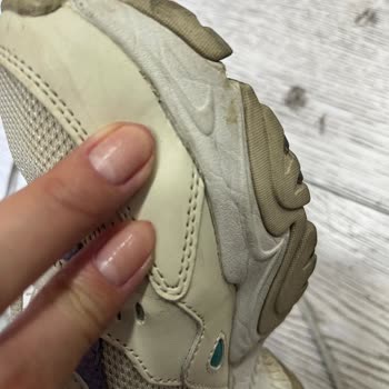 Skechers Ayakkabılarımın Tabanında Oluşan Soruna Çözüm Arıyorum