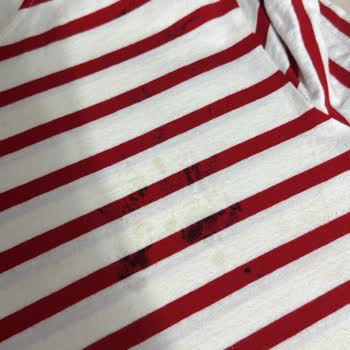 Philips Ütü İle Yaşanan Sürekli Sorunlar Ve Yetersiz Destek