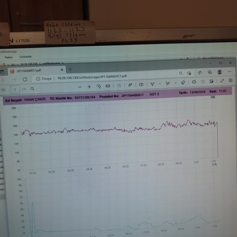 Giresun Kadın Doğum Hastanesi Doktor İhmali Yüzünden Kaybedilen Bir Can