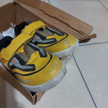 Ayakkabıda Soyulma Problemi Ve Olumsuz Geri Dönüş