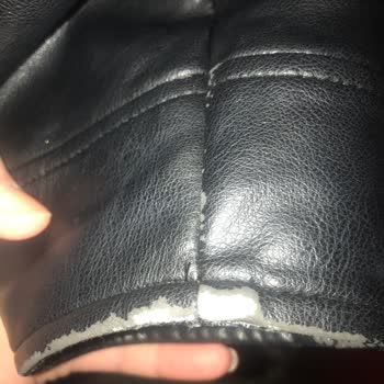 Ceketin Hızla Dökülmesi Karşısında Hayal Kırıklığı