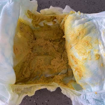 Bebeğimi Mahveden Mama: Sma3 Mavi Kapaklı Felaketi