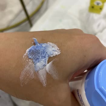 Bebek Kreminin İçinden Çıkan Yabancı Madde Şoku