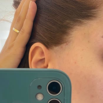 Güzellik Merkezinde Hayal Kırıklığı Ve Hijyen Sorunları