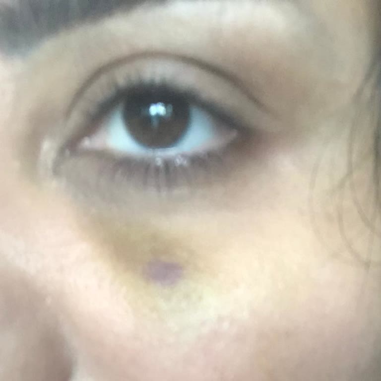 Esteworld'de Güven Sarsıcı Deneyim Ve Yanlış Uygulamalar