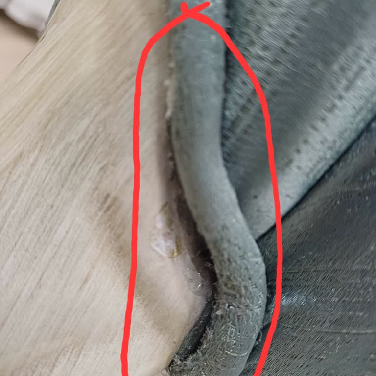 Yanlış Renk, Defolu Ürün Ve 10 Aylık Mağduriyet