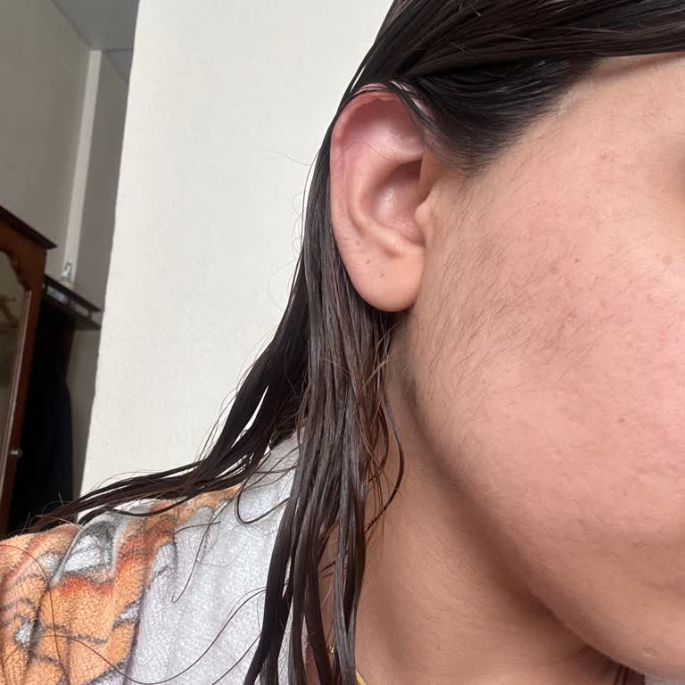 Lazer Epilasyon Deneyimi: Artan Tüyler Ve Hayal Kırıklığı