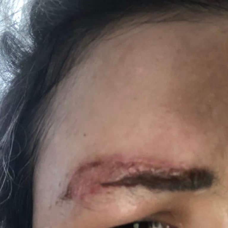 Yetkisiz İşlem Sonrası Kalıcı Hasar