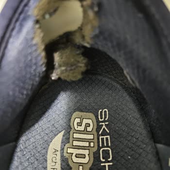 Skechers Ayakkabılarının Dayanıklılık Sorunu Ve Kötü Müşteri Hizmeti