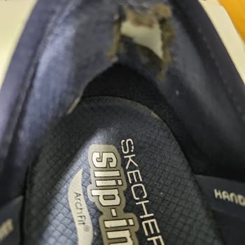 Skechers Ayakkabılarının Dayanıklılık Sorunu Ve Kötü Müşteri Hizmeti