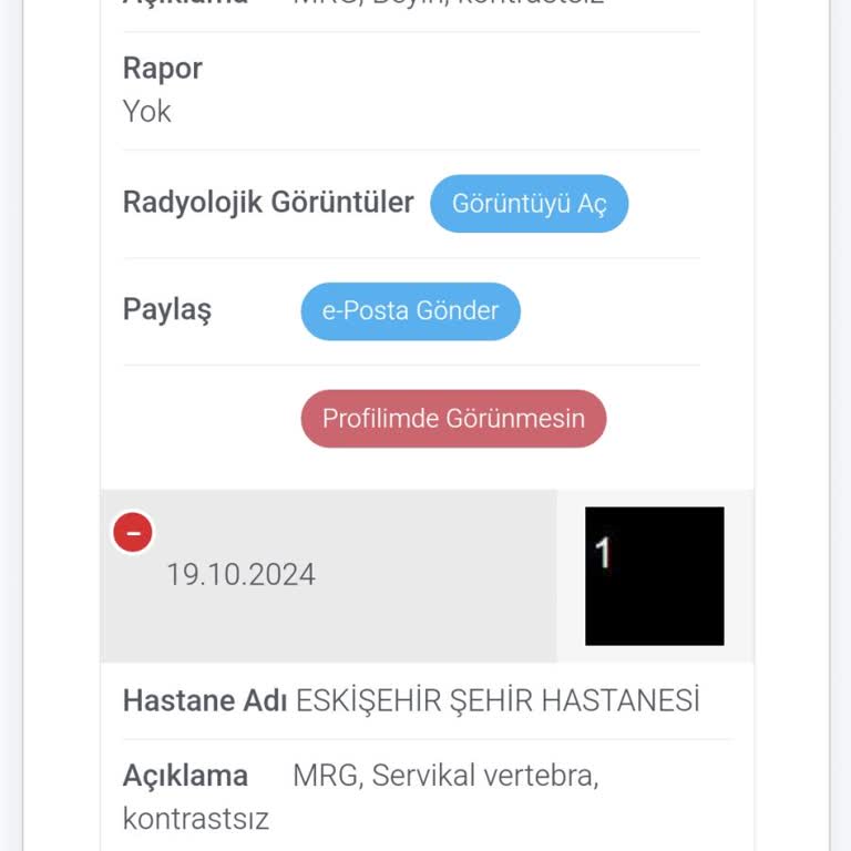Eskişehir Şehir Hastanesi'nde MR Raporu Gecikmesi