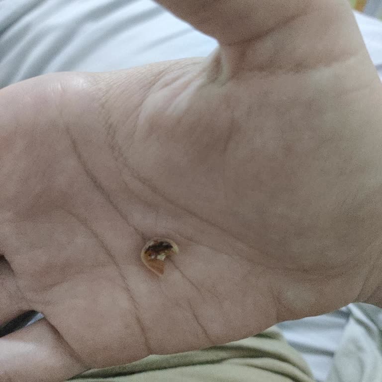 Helvanın İçinden Çıkan Tehlikeli Kabuk Parçası