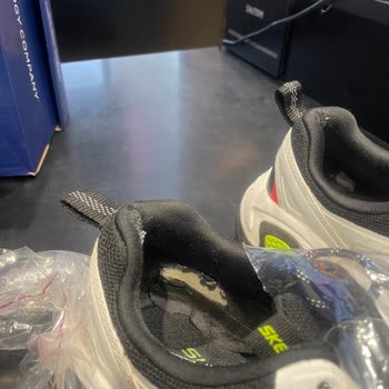 Skechers Ayakkabı 2 Ayda Delindi Ve Nasır Yaptı