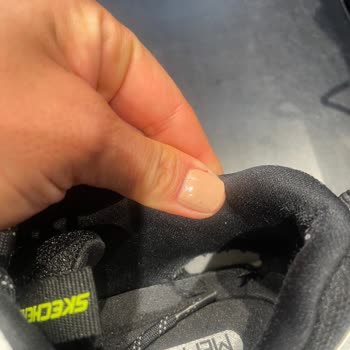 Skechers Ayakkabı 2 Ayda Delindi Ve Nasır Yaptı